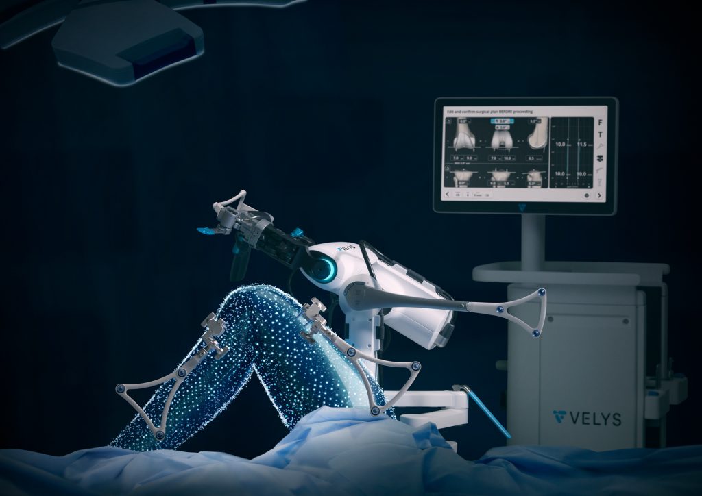 První robot v Česku mění kyčle v Mladé Boleslavi